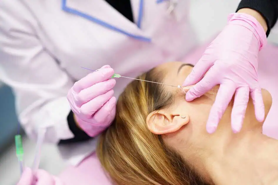 Is a PDO thread lift Painful? Managing Discomfort During the Procedure